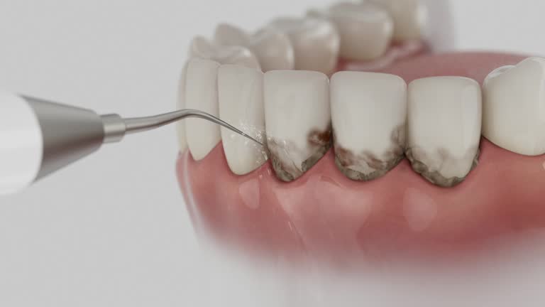 Reliable Tooth Extraction contractor in Kansas, KS by Dentist Open Now